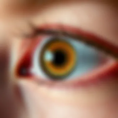 Symptoms of Acute Angle Glaucoma Illustration showcasing the symptoms and visual disturbances associated with acute angle glaucoma