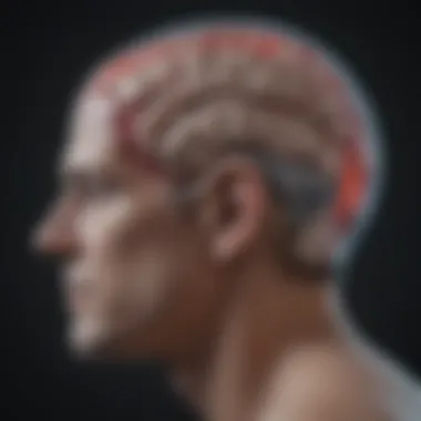 Insights from MRI on Anoxic Brain Injury MRI scan depicting anoxic brain injury