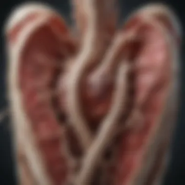 Detailed View of Calcified Aorta Illustration depicting the calcified aorta with highlighted areas of concern