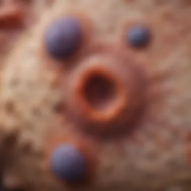 Microscopic Features of Basal Cell Carcinoma Microscopic view of basal cell carcinoma