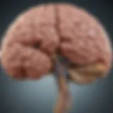 Diagram illustrating the brain regions affected by muscular sclerosis