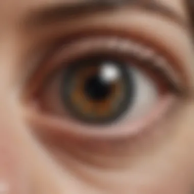 Anatomy of Eye Pigmentation Diagram showing anatomical structure of the eye related to pigmentation