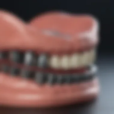 Metal frameworks for durability in partial dentures