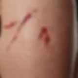 Clinical representation of purpuric rash on skin