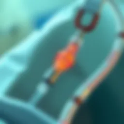 Detailed illustration of a PICC line in a neonatal setting