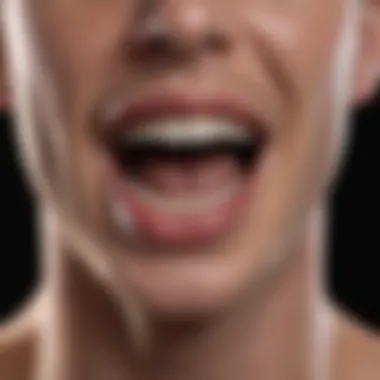 Understanding Dental Abscesses Visualization of dental abscess and its effects