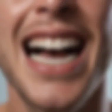 Successful Tooth Drainage Case Study Case study showcasing successful tooth drainage