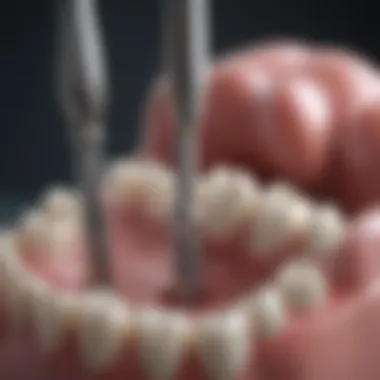 Dental Tools for Effective Drainage Dental tools used in drainage procedures