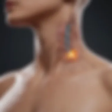Diagram showing the mechanism of radiation therapy targeting lymph nodes.