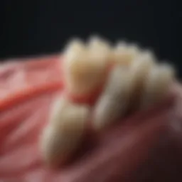 A close-up of dental grafting materials used in ridge preservation techniques.