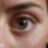 Diabetes-related eye complications