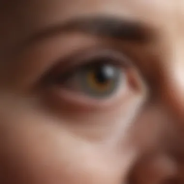 Exploring the Symptoms of Dry Eye Close-up of dry eye condition