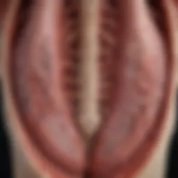 Illustration of vertebral hemangioma showing vascular structures