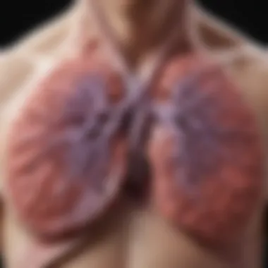 Impact of Sarcoidosis on the Lungs Diagram showing the impact of sarcoidosis on the lungs