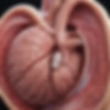 Graphic showing treatment options for severely dilated left ventricle