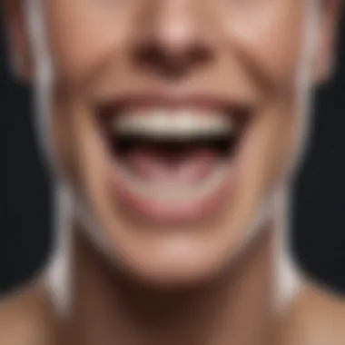 Anatomy of Smile Arc Diagram illustrating smile arc anatomy