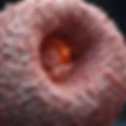 Histological representation of squamous cell carcinoma