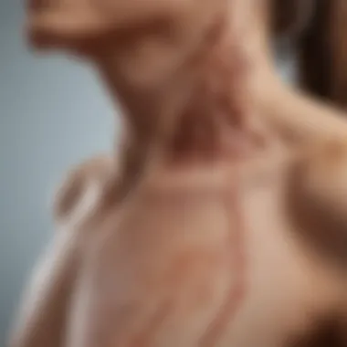 Skin Manifestations of Mycosis Fungoides Illustration depicting the skin manifestations of mycosis fungoides.